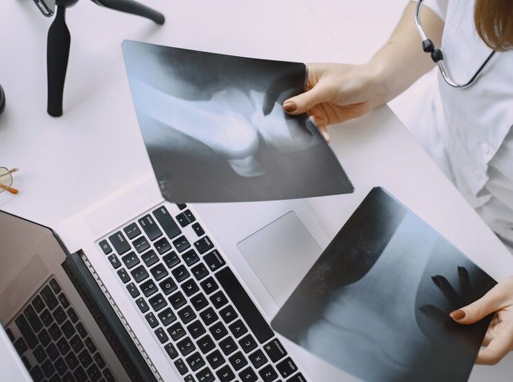 radiografia
